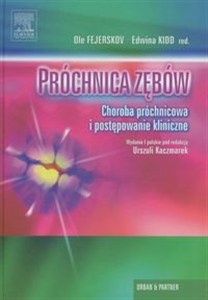 Picture of Próchnica zębów Choroba próchnicowa i postępowanie kliniczne