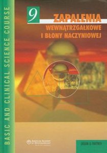 Obrazek Zapalenia wewnątrzgałkowe i błony naczyniowej