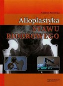 Alloplasty... - Andrzej Pozowski -  Książka z wysyłką do UK