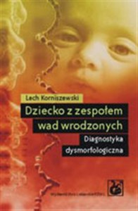 Obrazek Dziecko z zespołem wad wrodzonych Diagnostyka dysmorfologiczna
