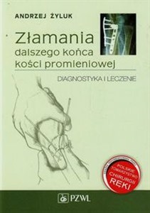 Obrazek Złamania dalszego końca kości promieniowej Diagnostyka i leczenie