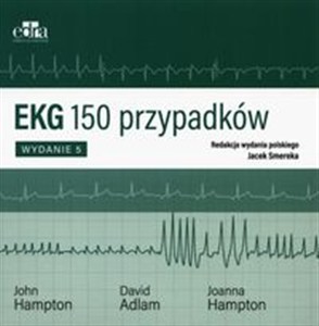 Obrazek EKG 150 przypadków