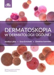 Picture of Dermatoskopia w dermatologii ogólnej