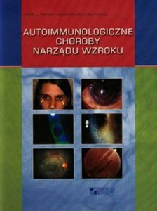 Obrazek Autoimmunologiczne choroby narządu wzroku