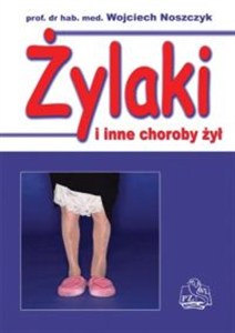 Picture of Żylaki i inne choroby żył