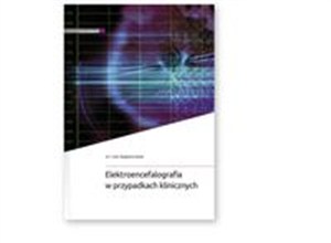 Picture of Elektroencefalografia w przypadkach klinicznych