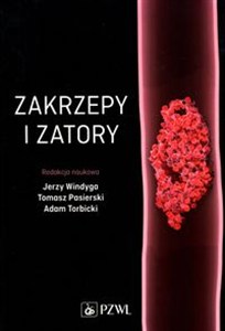 Obrazek Zakrzepy i zatory