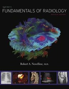 Picture of Squire's Fundamentals of Radiology Seventh Edition