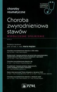 Obrazek Choroba zwyrodnieniowa stawów W gabinecie lekarza specjalisty