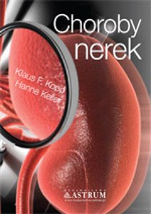 Picture of Choroby nerek