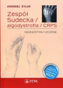Obrazek Zespół Sudecka / Algodystrofia / CRPS Diagnostyka i leczenie