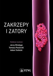 Obrazek Zakrzepy i zatory
