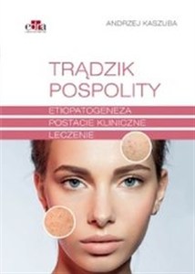 Obrazek Trądzik pospolity Etiopatogeneza. Postacie kliniczne. Leczenie