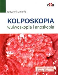 Obrazek Kolposkopia, wulwoskopia i anoskopia