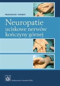 Obrazek Neuropatie uciskowe nerwów kończyny górnej