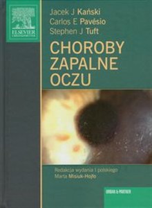 Obrazek Choroby zapalne oczu