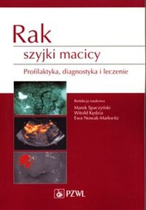 Obrazek Rak szyjki macicy Profilaktyka, diagnostyka i leczenie