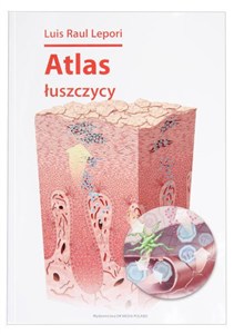 Obrazek Atlas łuszczycy