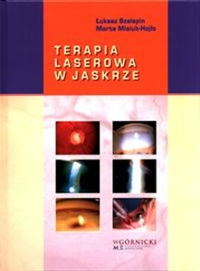 Picture of Terapia laserowa w jaskrze