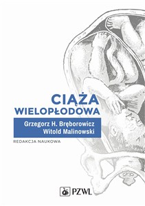 Obrazek Ciąża wielopłodowa