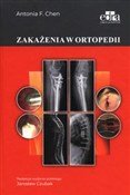 polish book : Zakażenia ... - A.F. Chen