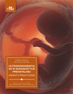 Picture of Ultrasonografia 3D w diagnostyce prenatalnej