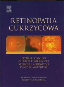 Obrazek Retinopatia cukrzycowa