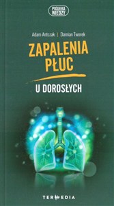 Picture of Zapalenia płuc