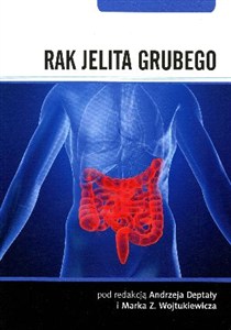 Picture of Rak jelita grubego
