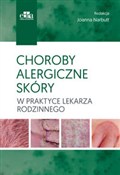 Zobacz : Choroby al...