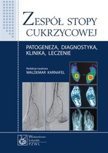 Obrazek Zespół stopy cukrzycowej Patogeneza, diagnostyka, klinika, leczenie