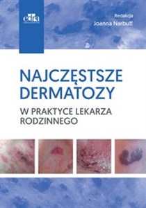 Obrazek Najczęstsze dermatozy w praktyce lekarza rodzinnego